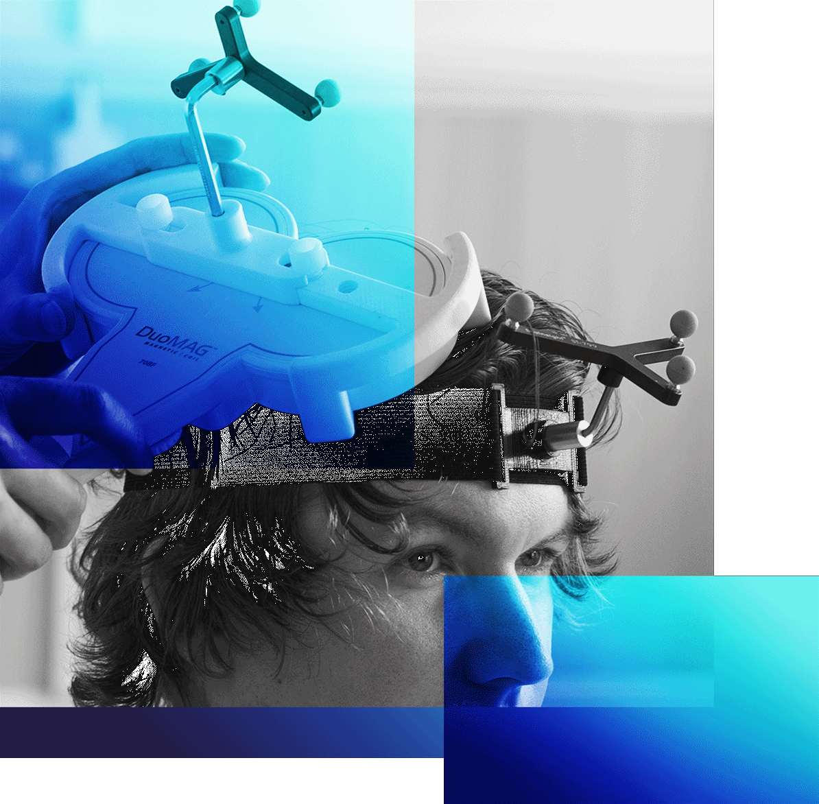 Pharmaco-TMS and qEEG in Rare Myclonic Epilepsy Condition